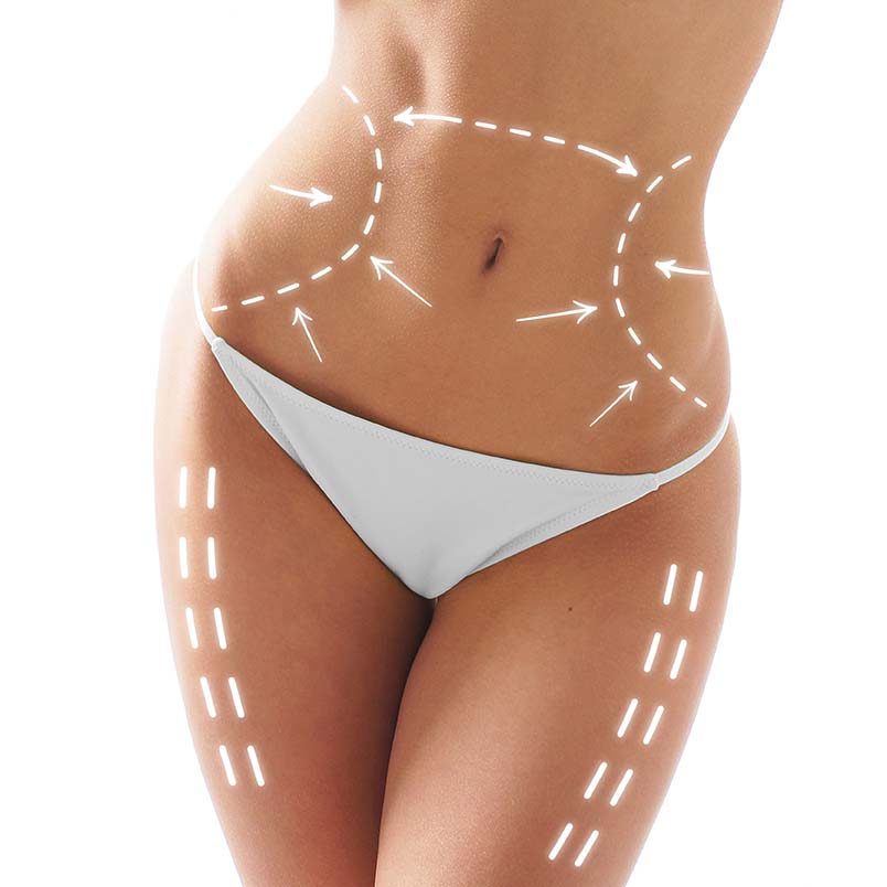 Body Contouring Service